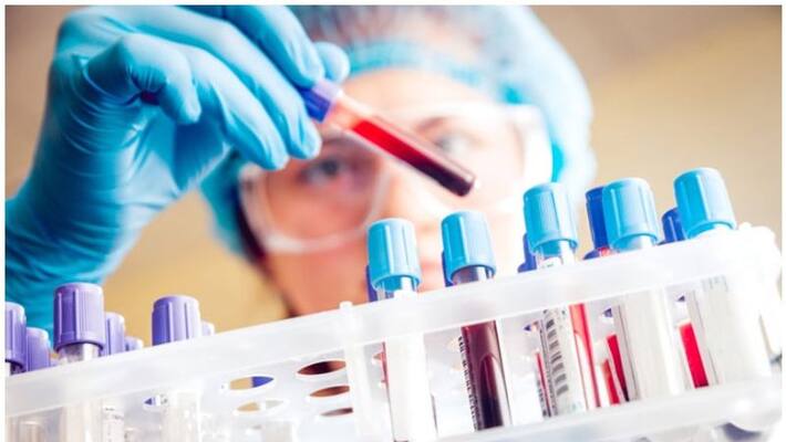 Karnataka Pooling of COVID-19 samples allowed in districts with less than 5% positivity rate -ymn Karnataka Pooling of COVID-19 samples allowed in districts with less than 5% positivity rate -ymn
