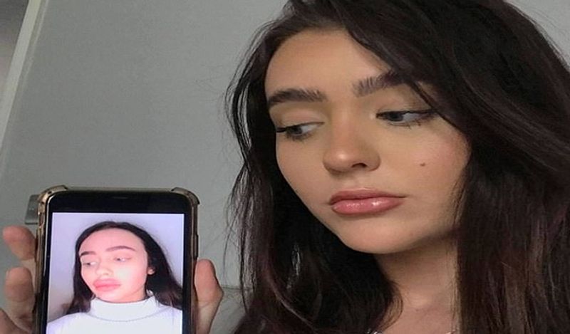 21 year old flight attendant lips surgery fail made her look like pig kph