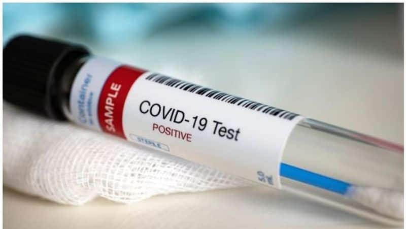 White House reveals India has done the second-most Covid tests after the US