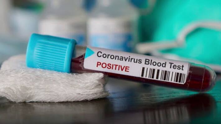 158 new covid 19 positive case confirmed in kozhikode 158 new covid 19 positive case confirmed in kozhikode