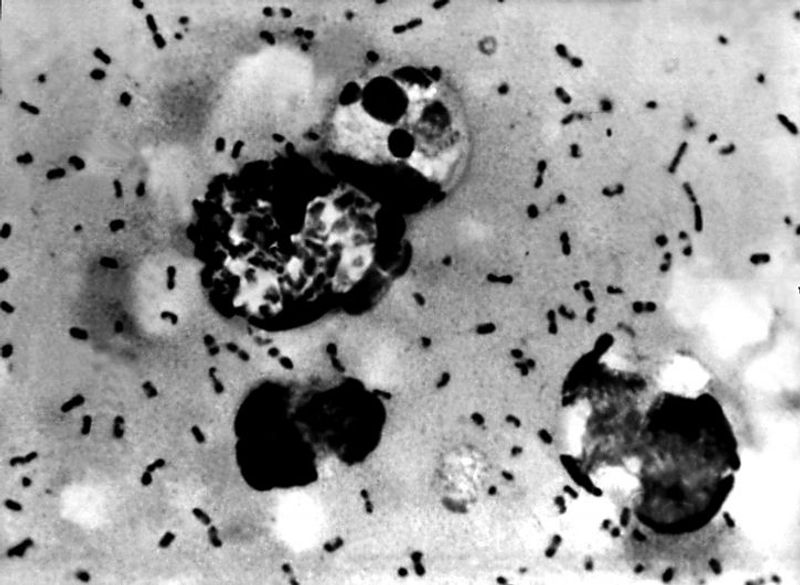 What is bubonic plague Symptoms causes and precautions you must know BSS