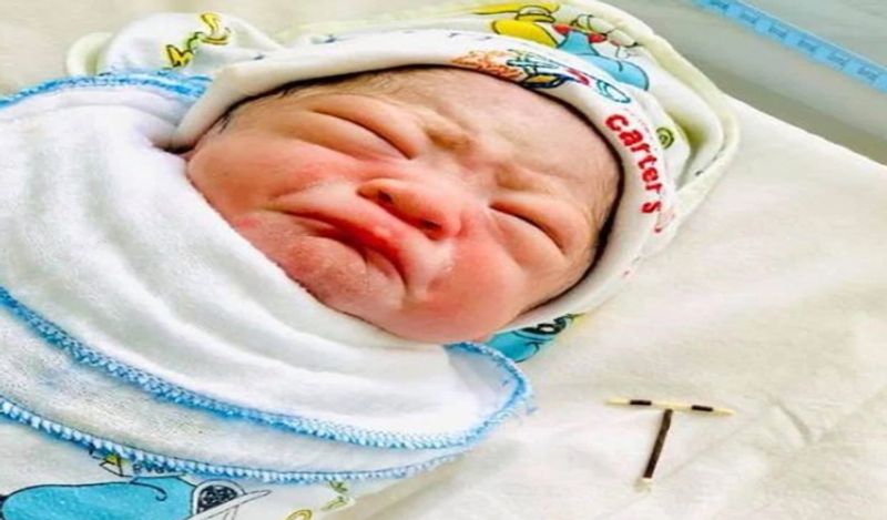 baby boy born holding mothers contraceptive coil from womb which was stopping her getting pregnant kph