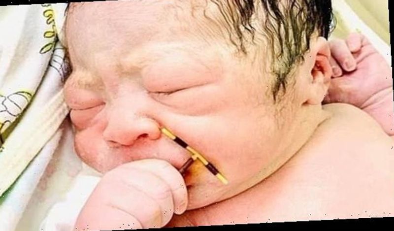 baby boy born holding mothers contraceptive coil from womb which was stopping her getting pregnant kph