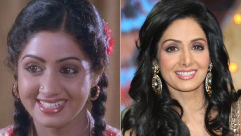 sridevi film mom completed three year of release actress done plastic surgery to look beautifull KPJ
