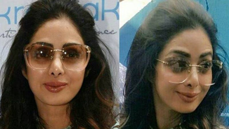 sridevi film mom completed three year of release actress done plastic surgery to look beautifull KPJ