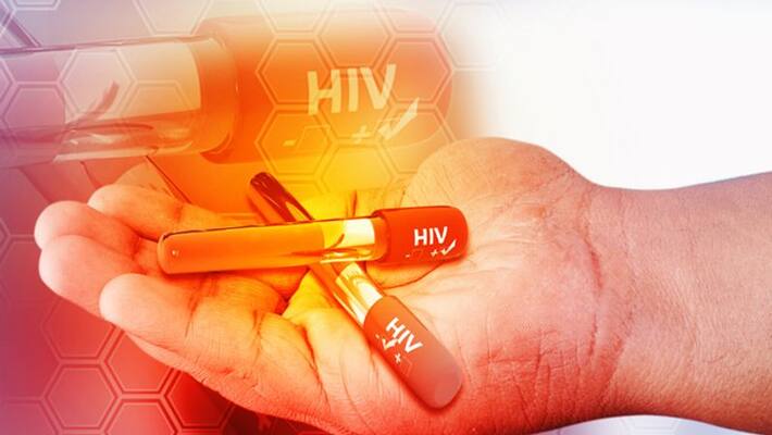 The first known person to be cured of HIV has died of cancer pod The first known person to be cured of HIV has died of cancer pod
