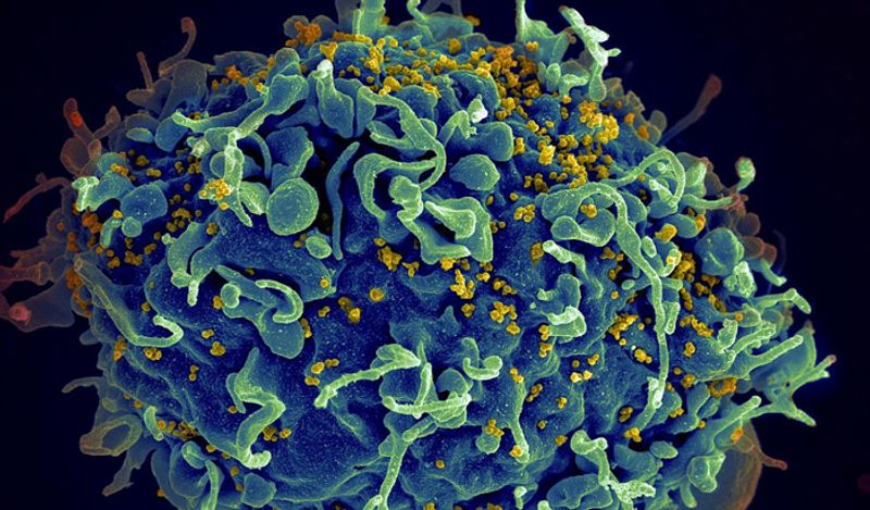 Biggest good news in Corona crisis brazilian researchers claims to find HIV drug makes it no longer incurable kph