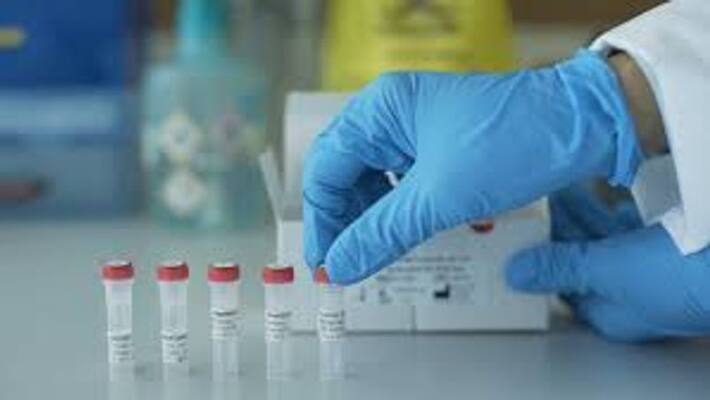 15 more Covid 19 positive in Kozhikode District 15 more Covid 19 positive in Kozhikode District