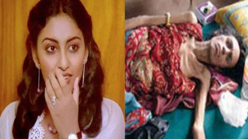 Actress Nisha Noor was turned into a skeleton before Dying KPG