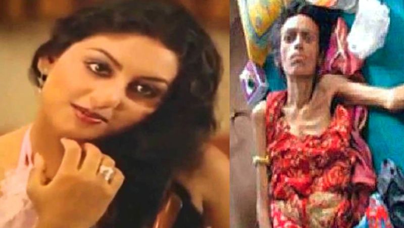 Actress Nisha Noor was turned into a skeleton before Dying KPG
