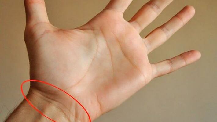 Tropic lines on palm tell about someone's life span and fate KPI Tropic lines on palm tell about someone's life span and fate KPI
