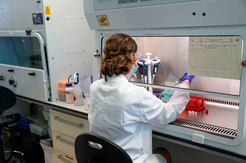 corona virus Russia says it plans to launch world first COVID 19 vaccine in mid August KPP