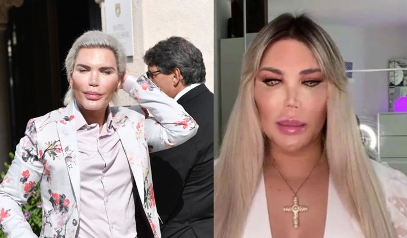 famous human ken doll rodrigo alves transformed into woman for having babies spend 52 lakh rupees kph