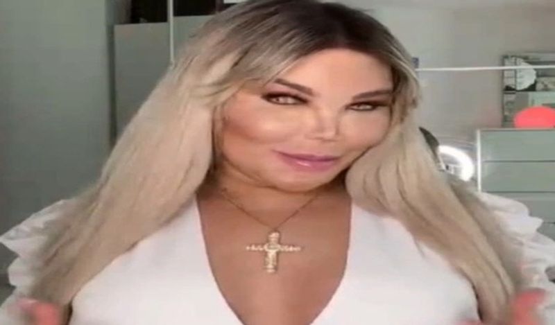 famous human ken doll rodrigo alves transformed into woman for having babies spend 52 lakh rupees kph