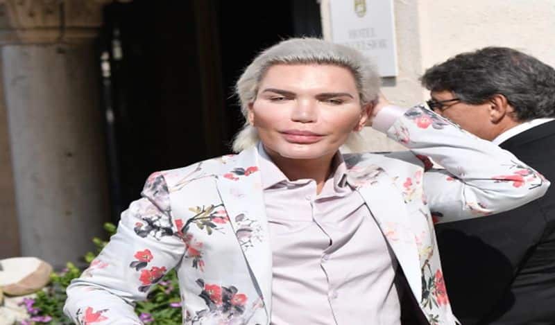 He did 72 surgeries to his face and become woman