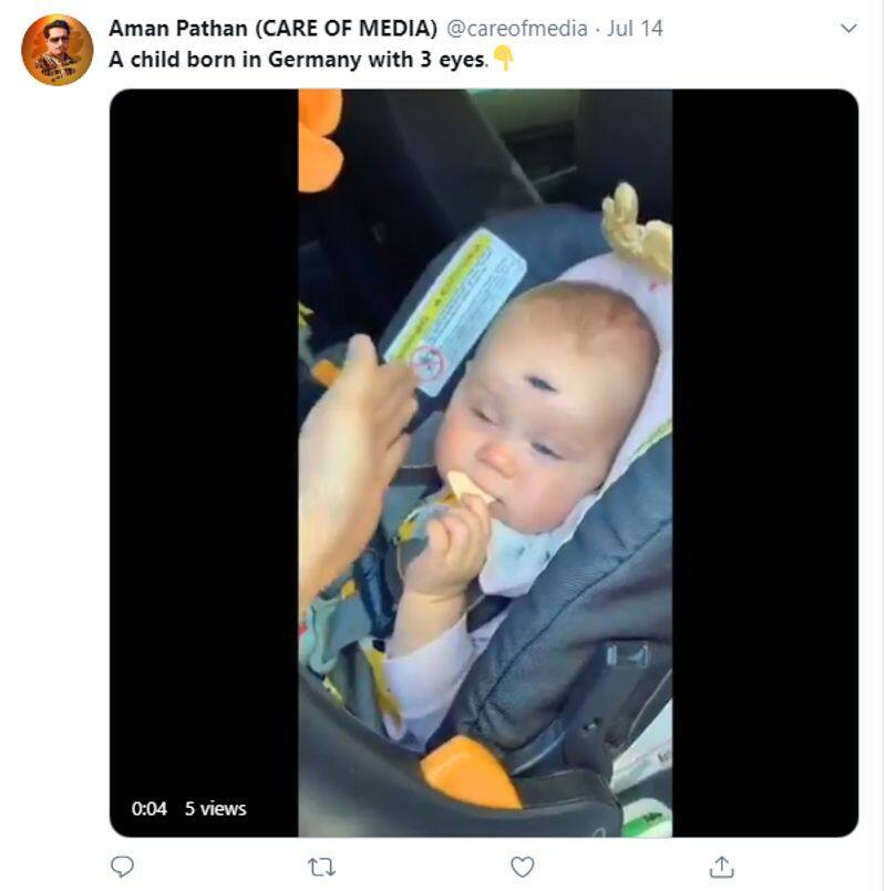 Edited Clip Viral As Three Eyed Baby Born