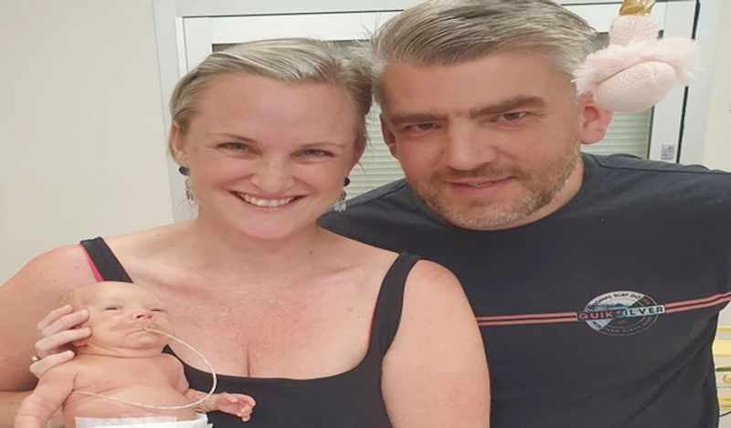 miracle baby girl born in just 24 weeks weighing 450 grams survival story kph