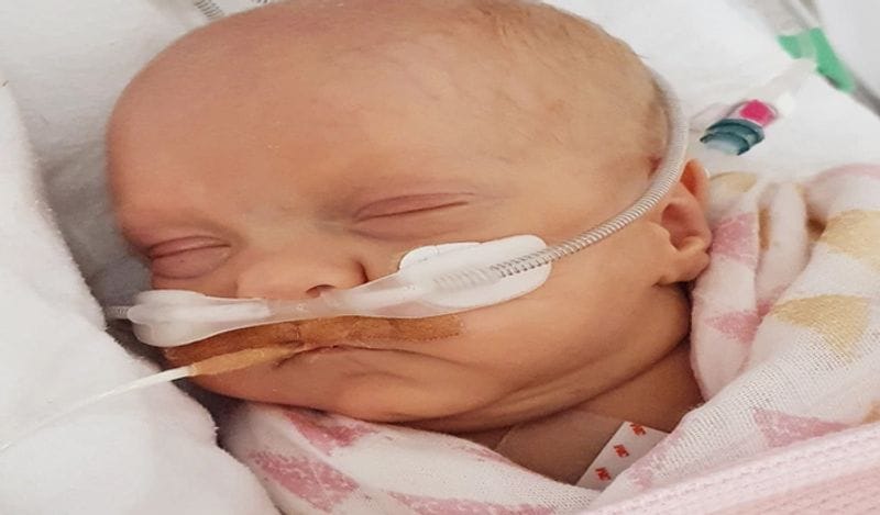 miracle baby girl born in just 24 weeks weighing 450 grams survival story kph