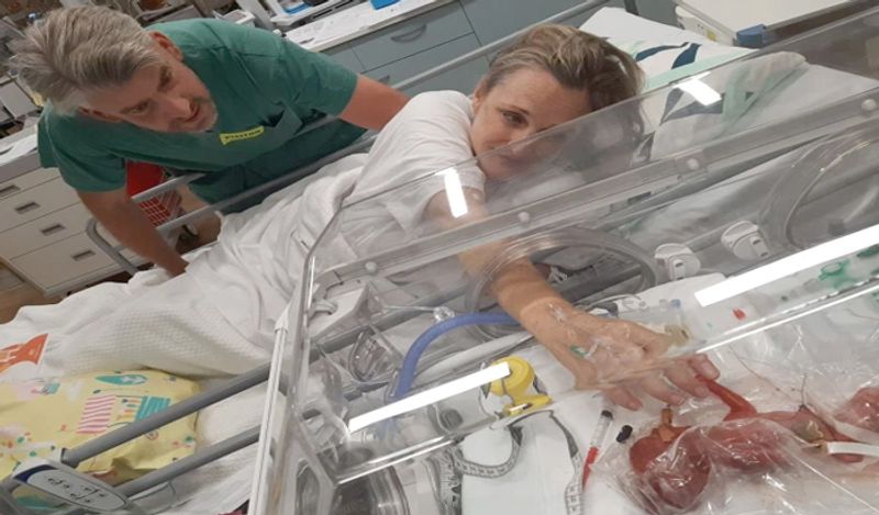 miracle baby girl born in just 24 weeks weighing 450 grams survival story kph