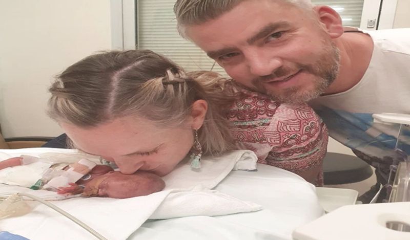 miracle baby girl born in just 24 weeks weighing 450 grams survival story kph