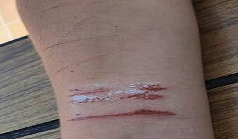 police issued warning as blue whale game again returned in lockdown encouraging teens to suicide kph