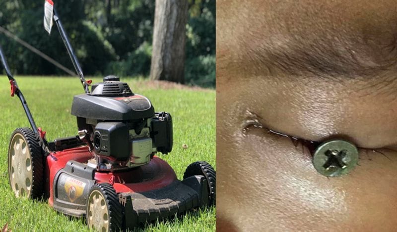 Out Of Fathers Negligence Iron Nail pierced in 3 year old boys eye ball in thailand