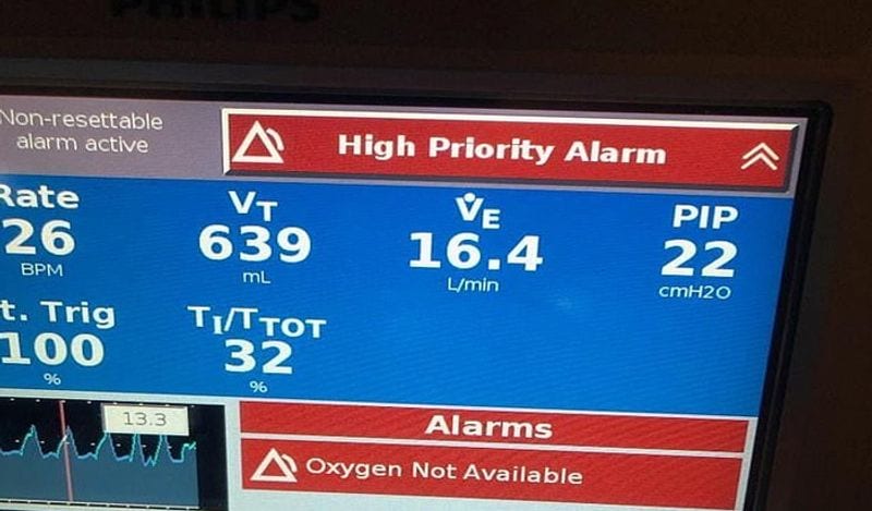 Americas condition worse than bihar in corona as photos of rotting corpses with ants crawling from texas hospital goes viral kph