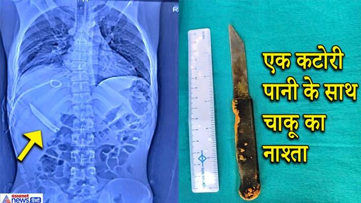 new Delhi news , a man Swallowed up Knife with water after not getting drugs kpa new Delhi news , a man Swallowed up Knife with water after not getting drugs kpa