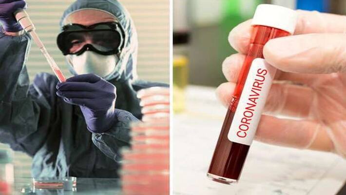 53 people died with corona virus in a single day in West Bengal BTD 53 people died with corona virus in a single day in West Bengal BTD