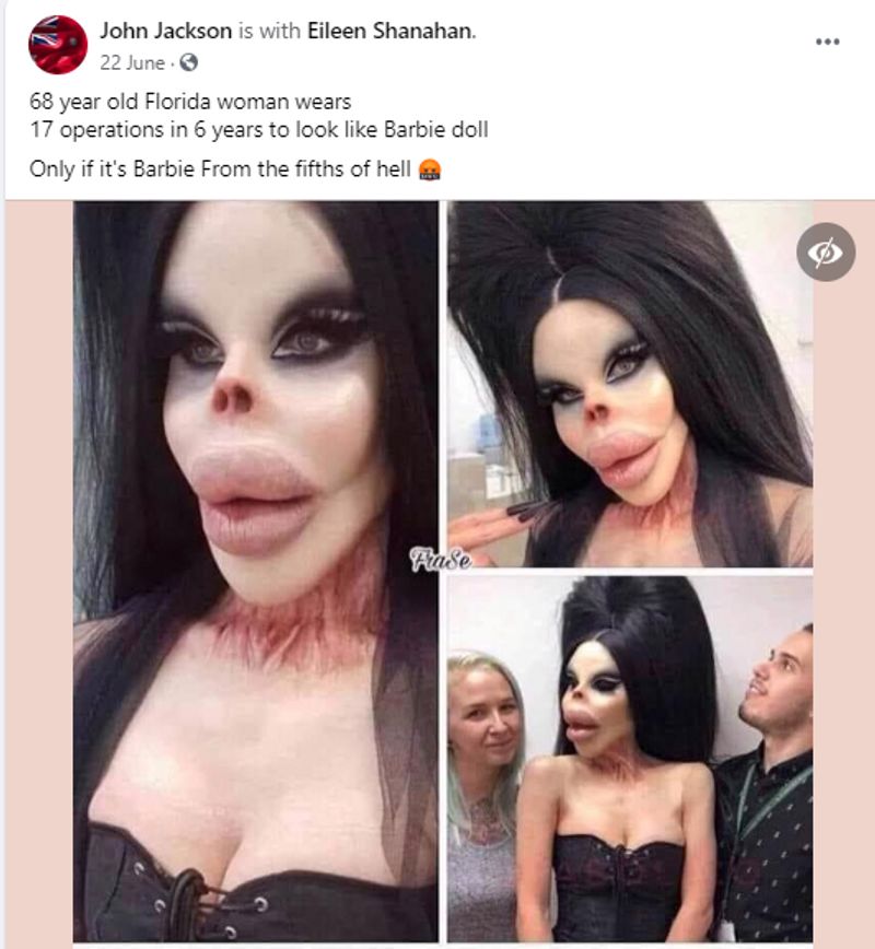 fake claim of woman underwent 17 surgeries to look like barbie doll kpt