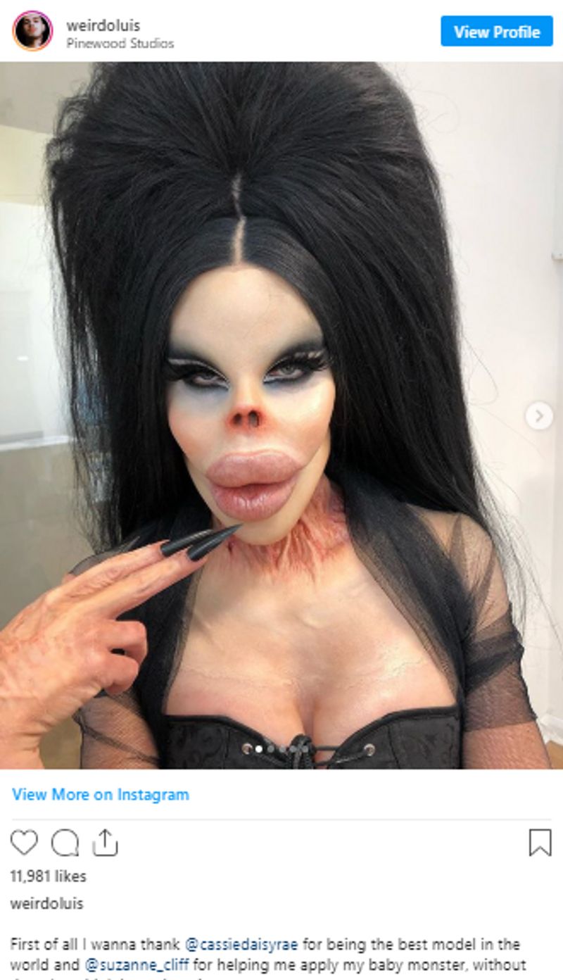 fake claim of woman underwent 17 surgeries to look like barbie doll kpt