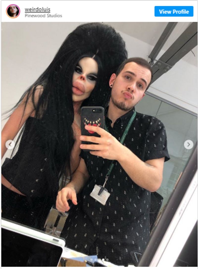 fake claim of woman underwent 17 surgeries to look like barbie doll kpt