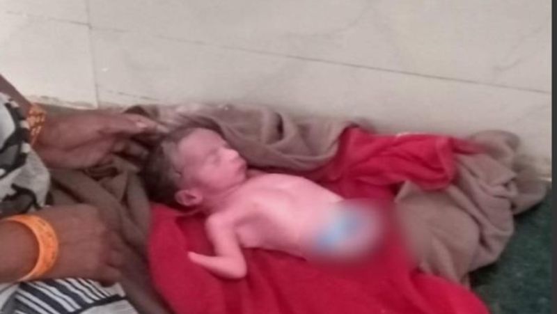 baby girl born with out arms and legs and people are assuming the miracle of god in MadhyaPradesh