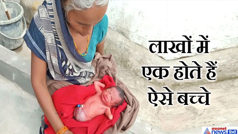 baby girl born with out arms and legs and people are assuming the miracle of god in MadhyaPradesh