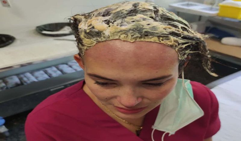 shocking incident freak lover attacked woman with hat filled with fevicol kph