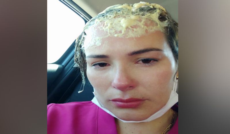 shocking incident freak lover attacked woman with hat filled with fevicol kph