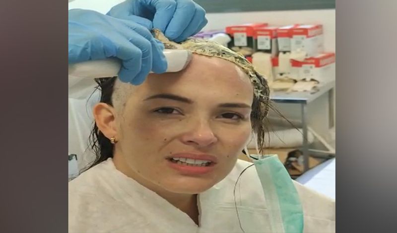 shocking incident freak lover attacked woman with hat filled with fevicol kph