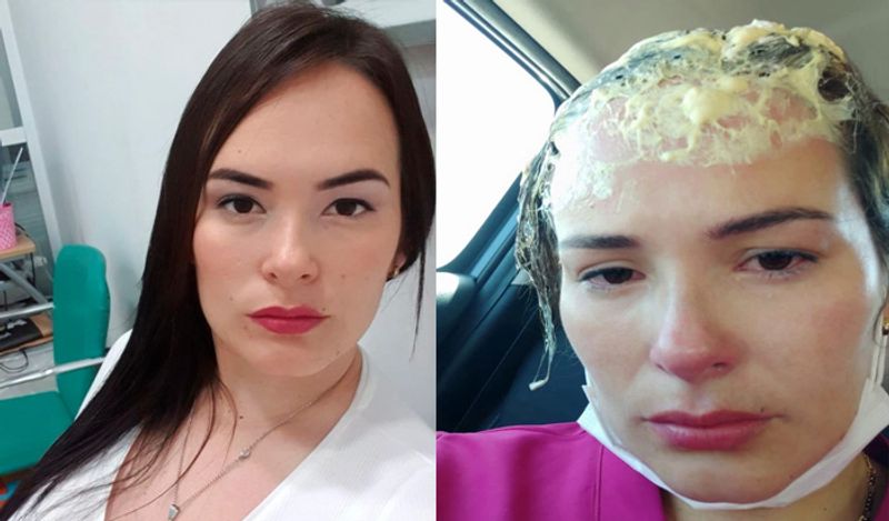 shocking incident freak lover attacked woman with hat filled with fevicol kph
