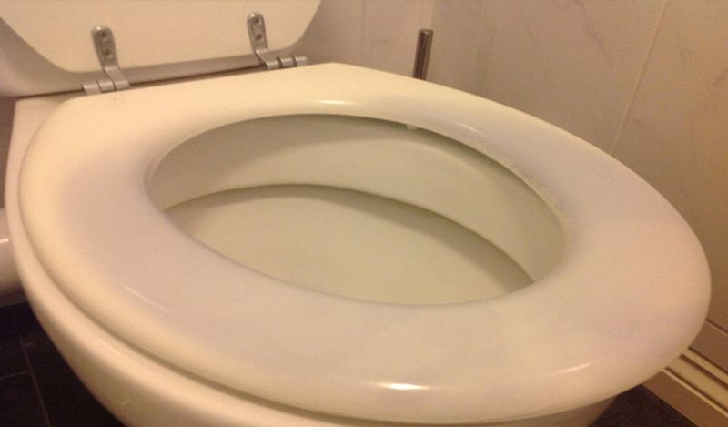 medical mystery womans potty turned into silver shocks doctors kph
