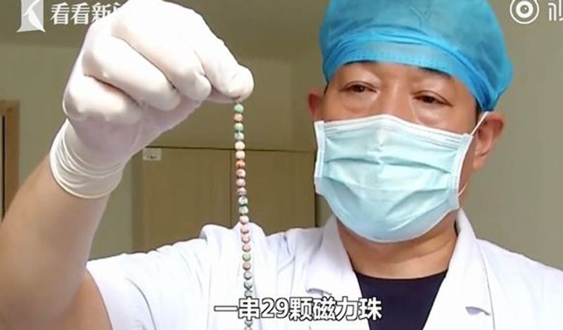man inserted 29 magnet balls inside private part for fun shocks doctor kph