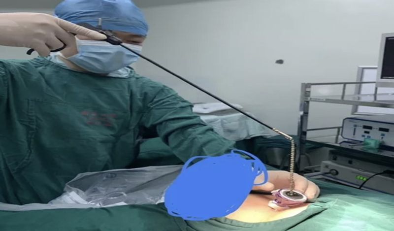 man inserted 29 magnet balls inside private part for fun shocks doctor kph