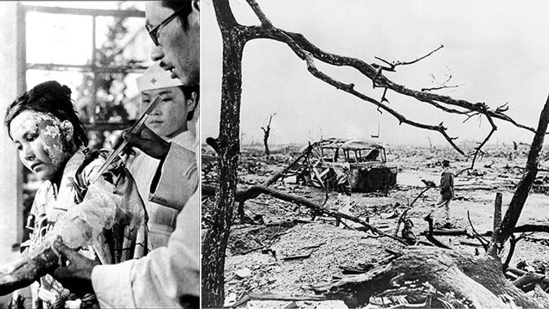 Shocking photos of the Second World War 1945, when the US attacked atomic bombs on the Japanese cities of Hiroshima and Nagasaki kpa