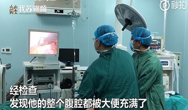 Man blocked bowel 'explodes' after he ate a big bowl of dumplings before doctors save him in emergency surgery