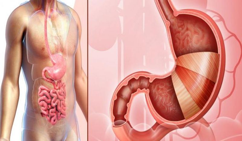 Man blocked bowel 'explodes' after he ate a big bowl of dumplings before doctors save him in emergency surgery