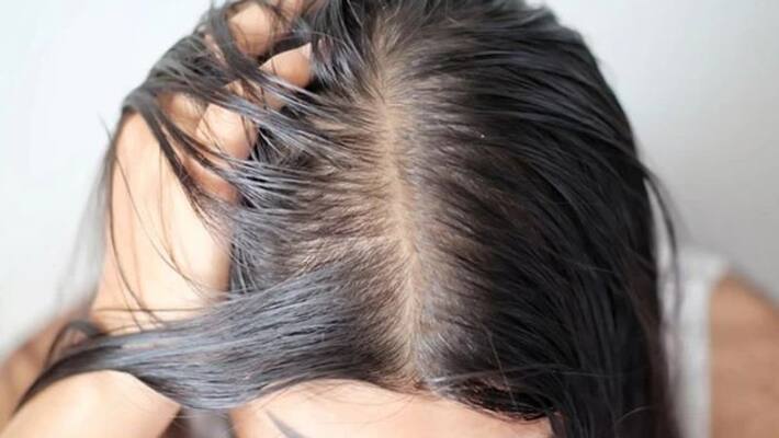 monsoon tips for those who have oily hair monsoon tips for those who have oily hair