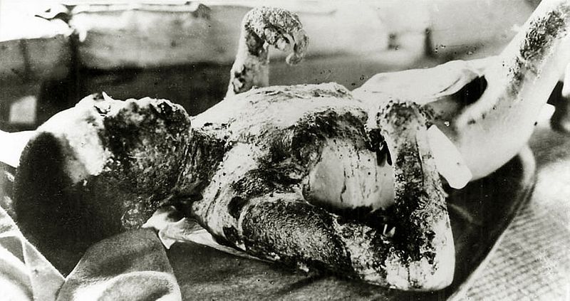 atomic bomb attack on Hiroshima and Nagasaki by america photos KPP