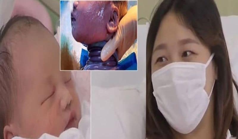 miracle baby in china suicides in mothers womb with umbilical cord wrapped in neck 6 times kph