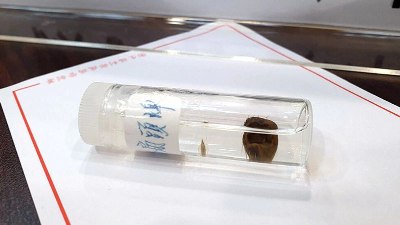 new type of virus in china killed seven so far KPP