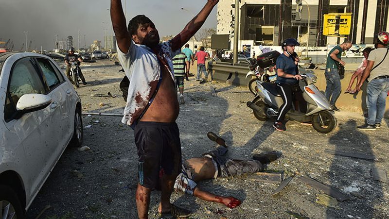 shocking photographs after the blast in Ammonium nitrate explosive in lebanon capital Beirut kpa
