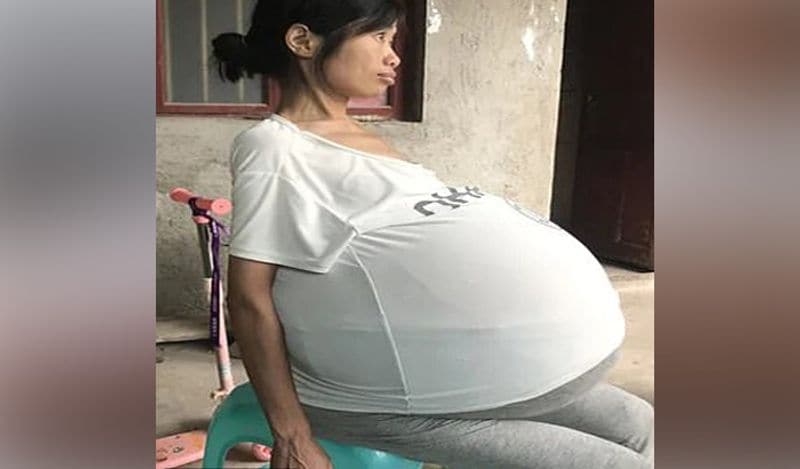 mysterious chinese woman whose belly ballooned uncontrollably from two years now begged for help kph